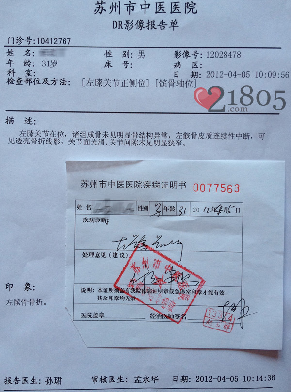 髌骨骨折